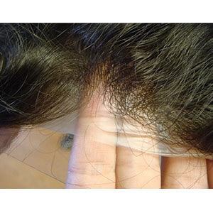 partial stock prosthesis indian hair