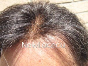 Glued Hair System (European Hair)