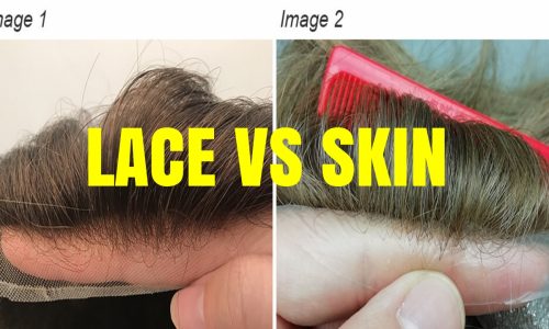 Hair-prothesis.. Lace vs Skin: WHICH IS THE BEST BASE? – Newlacecu