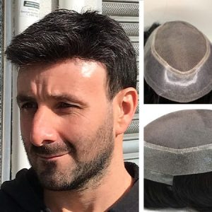 Male Hair Prosthesis