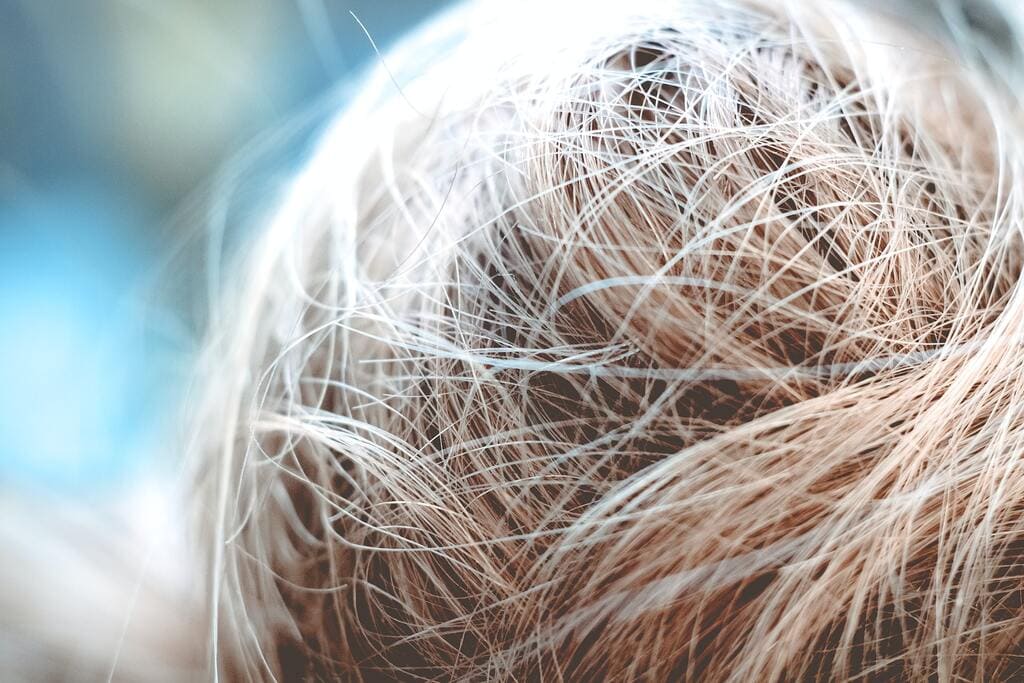 medical conditions that cause hair loss treatments