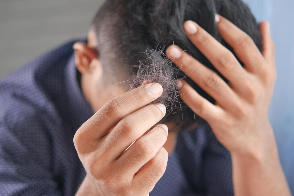 Laser treatment for hair loss alopecia