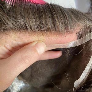 Horseshoe lace hair prosthesis