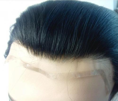 hair prosthesis lace systems man