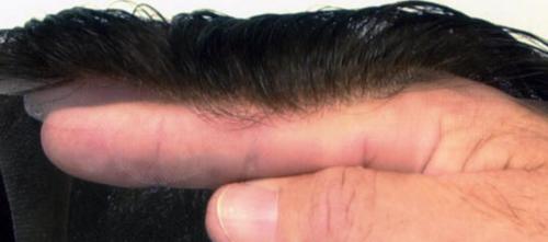 lace hairline system UK Baldness Banished